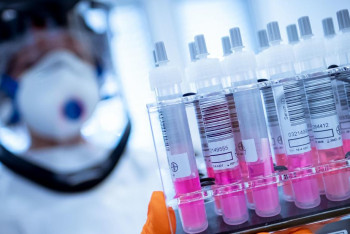 Фотография к новости: В Казахстане выявили около 100 новых случаев COVID-19 за сутки