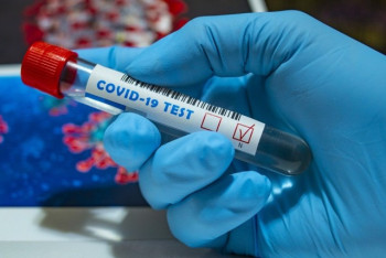 Фотография к новости: Коронавирусом за сутки заразились 22 казахстанца