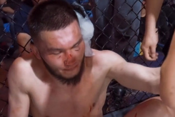 Фотография к новости: "Минус одно ухо": казахстанскому бойцу ММА нанесли серьёзную травму