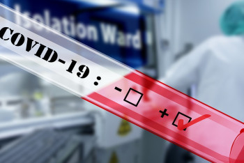 Фотография к новости: Коронавирусом за сутки заразились 32 казахстанца