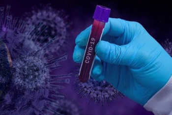 Фотография к новости: В Казахстане растёт заболеваемость коронавирусом