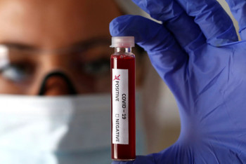 Фотография к новости: 45 казахстанцев заразились коронавирусом за сутки