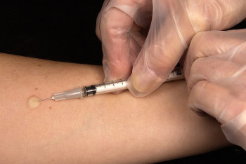 Фотография к новости: Упростить процедуру обследования на туберкулёз для бездомных просят в Костанае