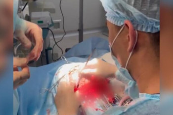 Фотография к новости: Врачи извлекли червей из мозга 10-летнего ребенка в Шымкенте