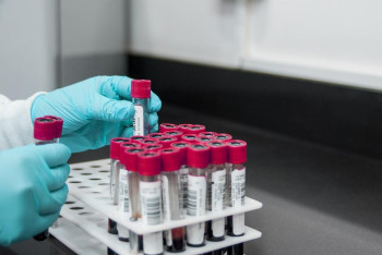 Фотография к новости: Ряд медуслуг могут стать недоступными для казахстанцев — НПП