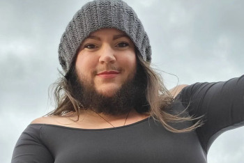 Фотография к новости: Бородатая женщина бросила вызов врачам и родила ребёнка