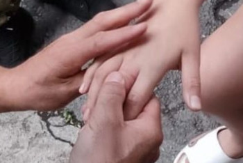 Фотография к новости: Спасатели ВКО помогли девочке снять кольцо с отёкшего пальца