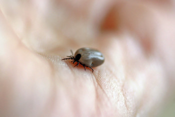Фотография к новости: Опасную лихорадку выявили у девяти жителей Туркестанской области