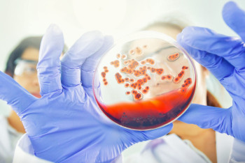 Фотография к новости: Врачи рассказали, как обезопасить себя от "летних" инфекций