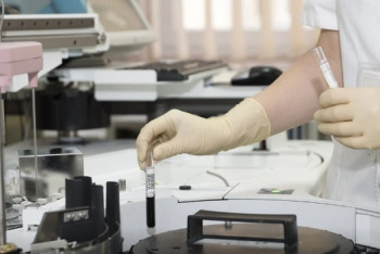 Фотография к новости: Новые случаи кори фиксируют у детей в Мангистау