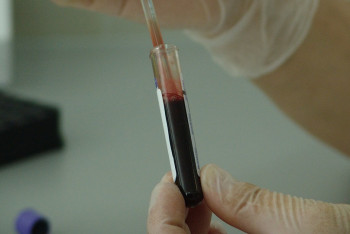 Фотография к новости: Двое несовершеннолетних заразились ВИЧ в Астане