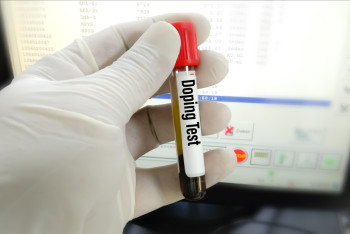 Фотография к новости: Как проверяют спортсменов на допинг в Казахстане?