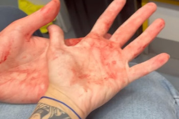 Фотография к новости: Жительниц Астаны избила незнакомка