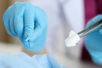 Фотография к новости: "Это деликатная работа": врач рассказал, как правильно должно проводиться обрезание