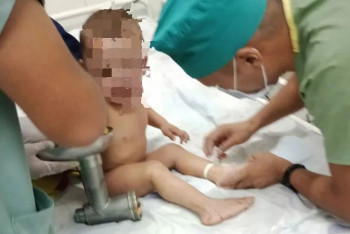 Руку двухлетнего ребёнка достали из электромясорубки в Шымкенте