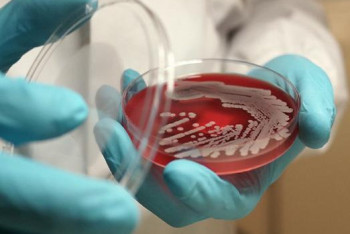 Фотография к новости: Житель села области Абай, у которого подозревают сибирскую язву, работает в сельской школе