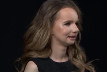 Изувеченной родственниками алматинке провели бесплатные операции