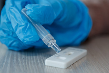 Фотография к новости: 113 случаев коронавируса зарегистрировали в Казахстане за неделю