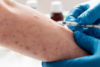 Девять детей попали в реанимацию из-за вспышки кори в Атырауской области