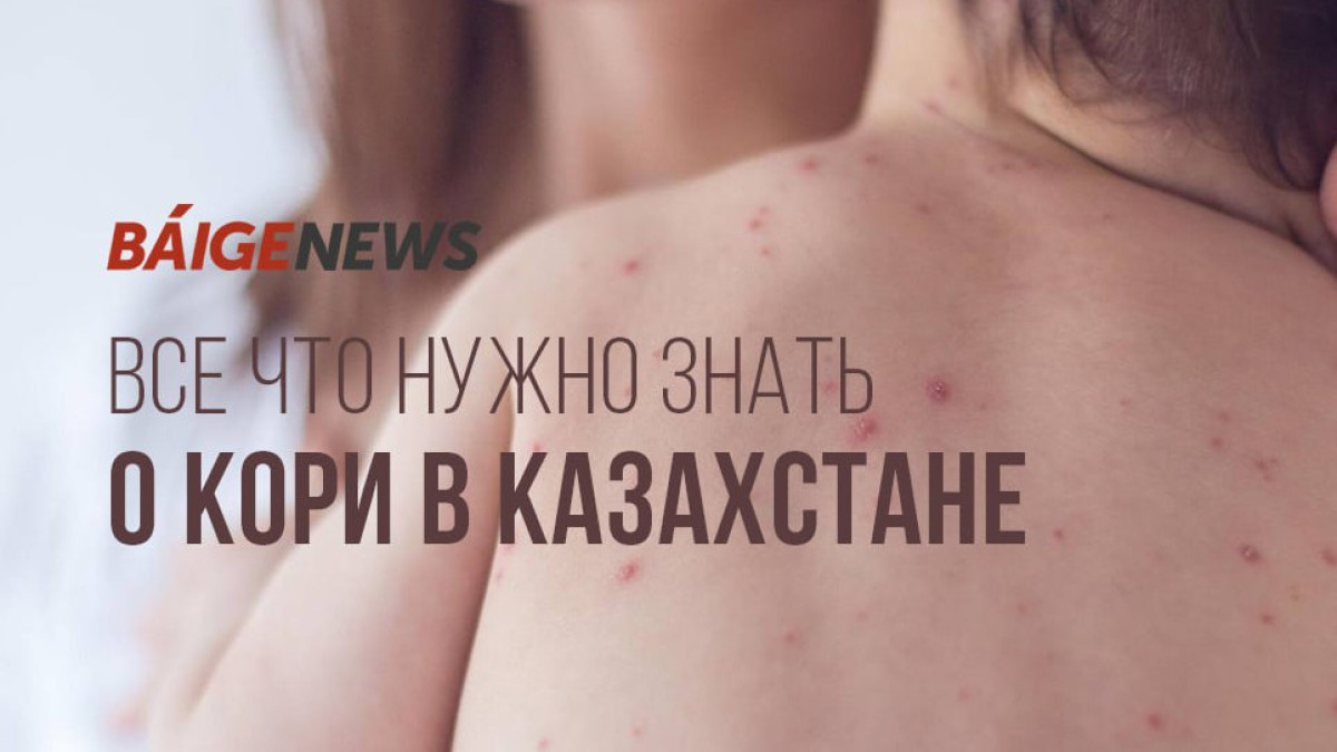 Эксперт дал прогноз по ситуации с корью в Казахстане
