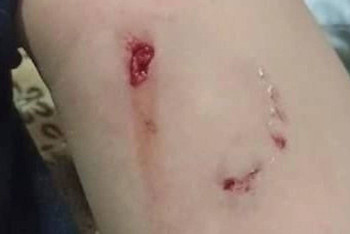 Собака покусала семилетнюю девочку в Усть-Каменогорске