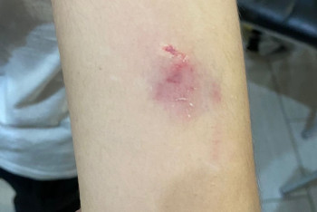 Собака укусила школьника на уроке физкультуры в Актау