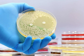 Фотография к новости: Ученые впервые открыли новые антибиотики с помощью искусственного интеллекта