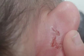 Восьмилетняя девочка рассказала об истязаниях опекуна в Алматинской области