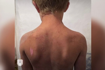 Фотография к новости: Била и запирала в сарае: мать издевалась над сыном в области Жетысу