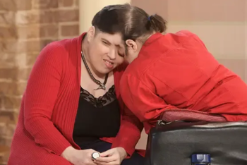 Умерли самые старые в мире сиамские близнецы