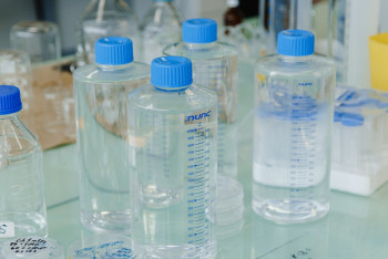 Вспышки заболеваемости кишечными инфекциями в СКО не зарегистрировано – санэпидконтроль