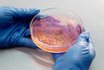 Фотография к новости: Искусственный интеллект выявил почти 200 новых вирусов