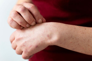 Заболеваемость растёт из-за непривитых детей: санврачи о случаях кори и коклюша в Казахстане