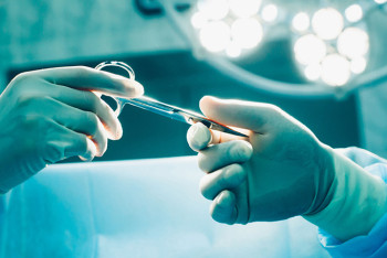 Фотография к новости: Хирург случайно удалил пациенту печень вместо больной селезенки