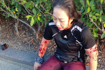 Фотография к новости: Выдры чуть не загрызли девушку в Малайзии