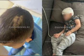 Фотография к новости: Ребёнка ударили стулом по голове в детсаду в Астане