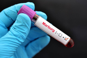 Фотография к новости: Минздрав усиливает контроль из-за угрозы новой опасной инфекции