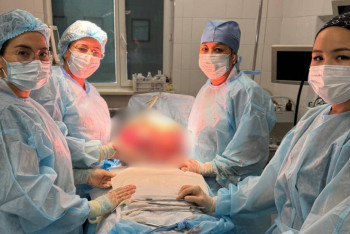 Фотография к новости: Гигантскую миому удалили пациентке в Таразе