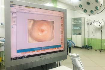 Фотография к новости: Сколько женщин ежегодно заболевают раком шейки матки в Казахстане