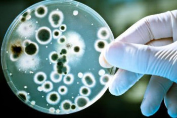 Фотография к новости: Как не заболеть сибирской язвой: рекомендации Минздрава РК