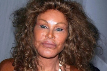 Фотография к новости: Умерла женщина-кошка Джослин Вильденштейн