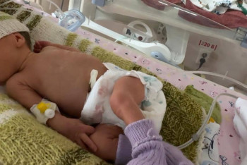 Фотография к новости: 44 дня боролись за жизнь ребёнка врачи в Алматы