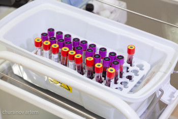 Фотография к новости: Скрининг на выявление гепатитов В и С внедрят в Казахстане