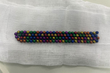 Двухлетний малыш проглотил 105 магнитов в Алматы