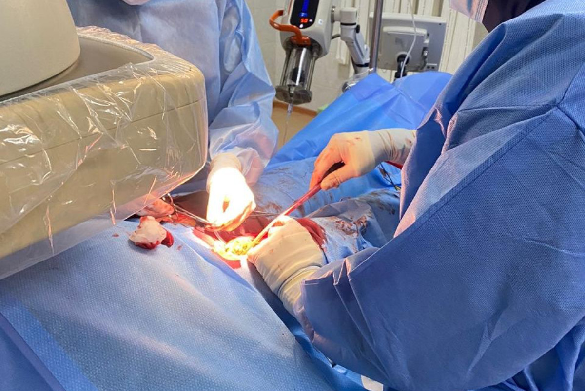 Уникальную операцию на аорте провели алматинские хирурги