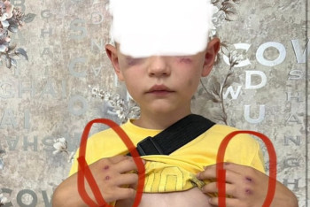 Фотография к новости: Восьмилетнего ребёнка избили в Лисаковске