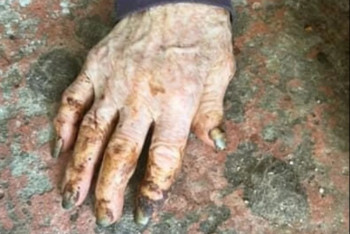 Брошенная и забытая: в Шымкенте женщина-тыловик жила в нечеловеческих условиях