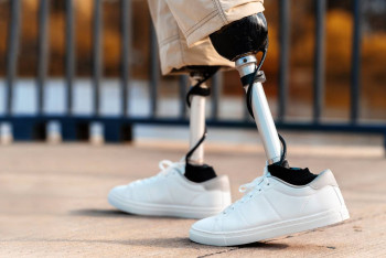 Фотография к новости: Девочке ампутировали ноги после ДТП: семья ищет средства на качественные протезы