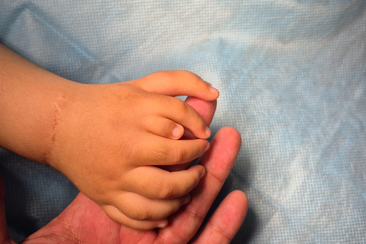 Малышу удалили лишние пальцы в Алматы, чтобы он мог держать игрушки