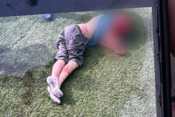 Фотография к новости: Нападение бойцовских собак: мальчика перевели в детскую больницу Алматинской области